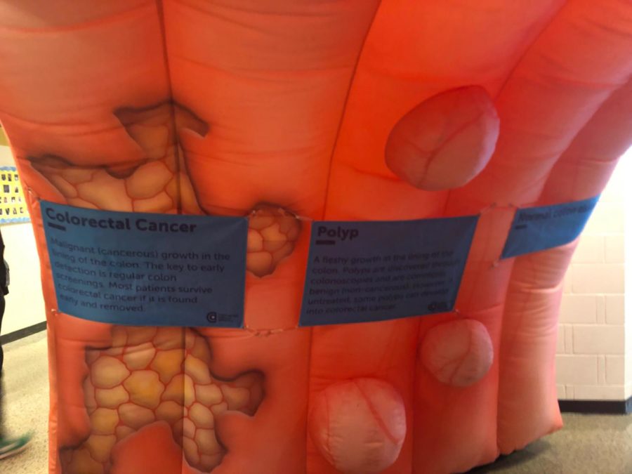 This colon inflatable shows facts about this common form of cancer.